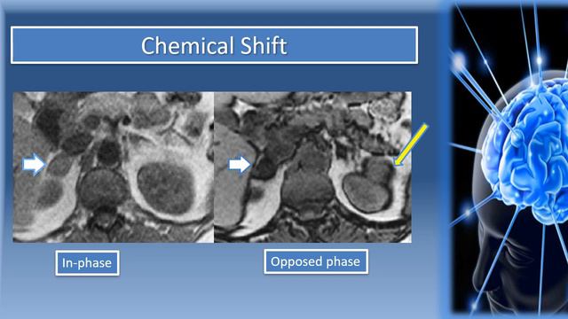 How To Recognize MRI Sequences: Part II смотреть онлайн