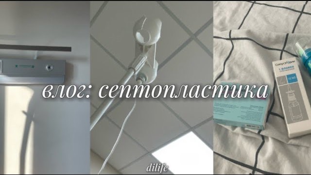 влог: септопластика🩺 смотреть онлайн