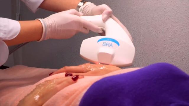 ELOS видалення пігментації смотреть онлайн