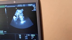 ?Едем на УЗИ?Пол малыша?дневник беременности?второй скрининг?гадание по нитке и иголке
