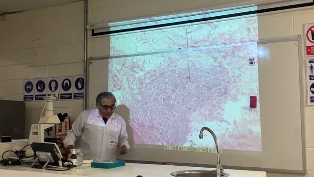 Actinomicosis (Actinomyces israelí) y granuloma de tipo cuerpo extraño смотреть онлайн