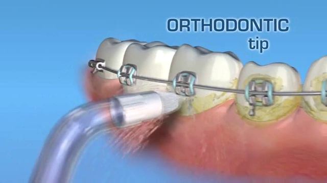 Końcówka ortodontyczna OD-100 do irygatorów WATERPIK смотреть онлайн