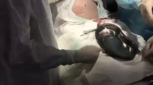 Троакарная цистостомия у пациента с нейрогенным мочевым пузырем после ОНМК
