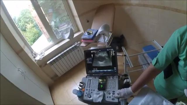 Трепан биопсия подчелюстного лимфоузла смотреть онлайн