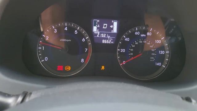 2016 Hyundai Elantra speedometer and instrument cluster failure. смотреть онлайн