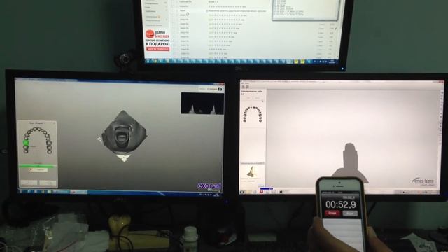 Scanning speed of 3Shape 710 and Medit SE смотреть онлайн
