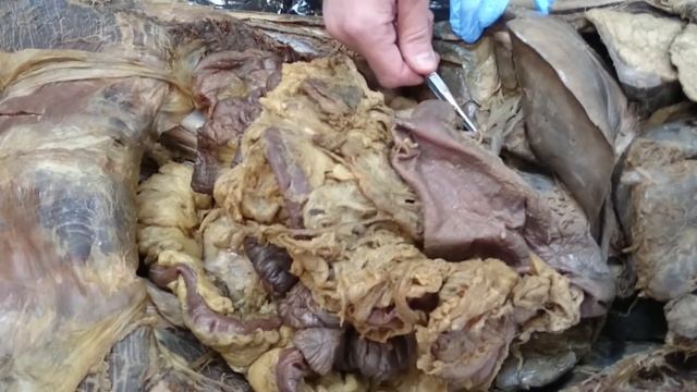 Брюшина и пространства