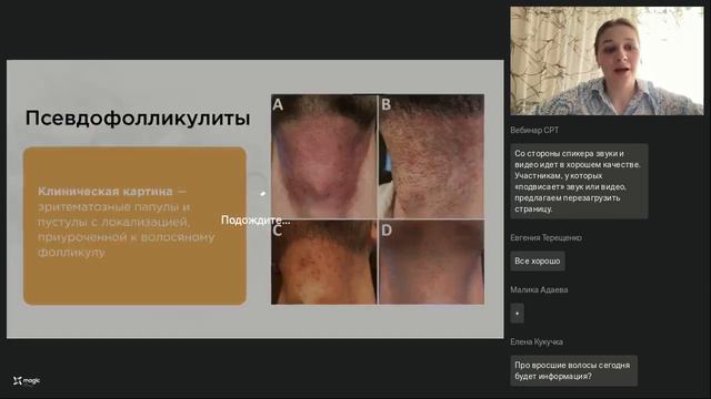 Парадоксальные реакции при эпиляции