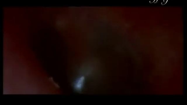 Чудо слуха человека смотреть онлайн