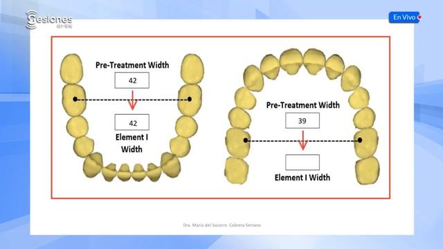 Sesión On-Line: "Armonía orofacial de los 6 elementos del Dr. Andrews" смотреть онлайн