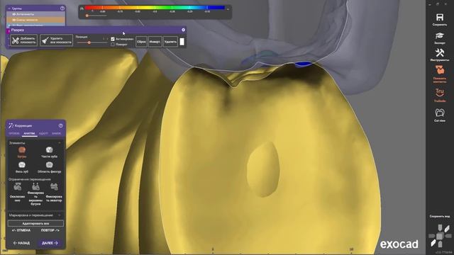 EXOCAD Изготовление прототипа для балочной конструкции All-on-4.