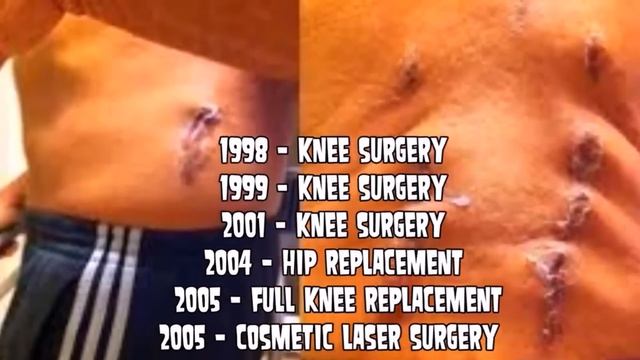 Hulk Hogan's Wrecked Back, $50 Million Dollar Lawsuit, John Cena Match смотреть онлайн