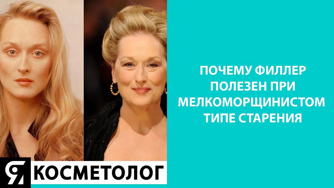 Почему филлер полезен при мелкоморщинистом типе старения смотреть онлайн