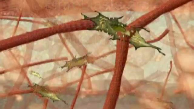 Иваново липосакция.mp4 смотреть онлайн