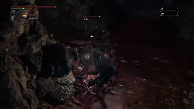 BLOODBORNE: THE OLD HUNTERS DLC - Easy Way to Kill the Gatling Gun Hunter смотреть онлайн