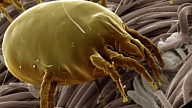 Застилать постель опасно? | Актуально смотреть онлайн