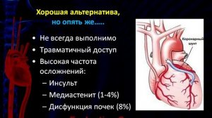 Коронарное стентирование: преимущества и недостатки, как можно улучшить результаты стентирования