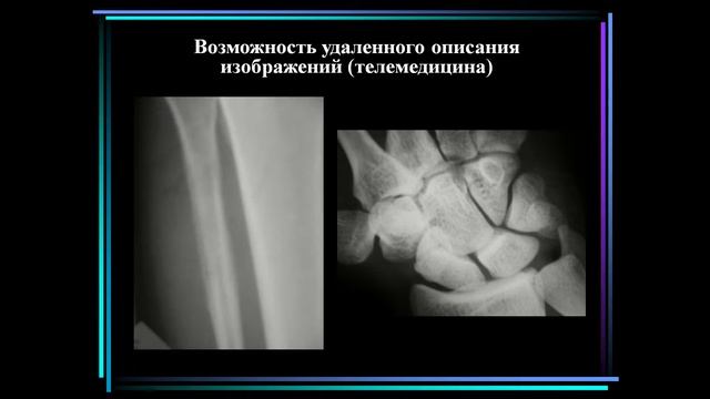 23 03 2017 Шармазанова Цифровая рентгенодиагностика СМС смотреть онлайн