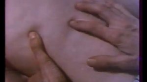 3.4.  Острая лучевая болезнь