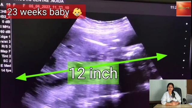 6th month baby on ultrasound/ Baby development смотреть онлайн