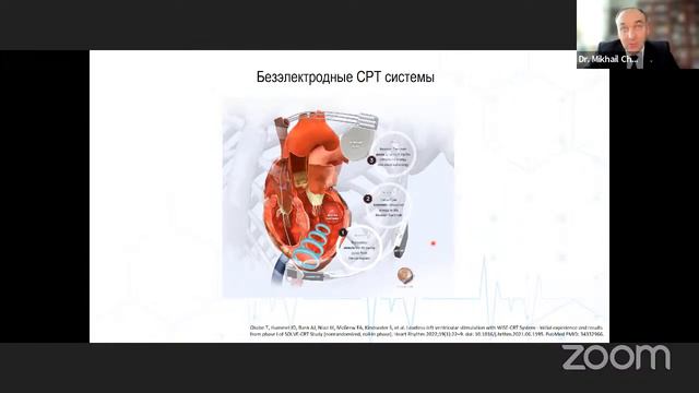 Новые методы и перспективы физиологической электрокардистимуляции смотреть онлайн