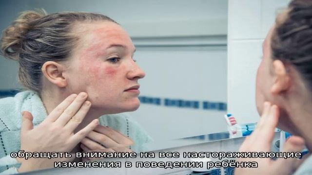 Все об аллергии на коровье молоко у грудничков смотреть онлайн