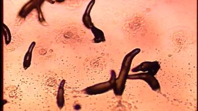 Dictyostelium - a Cellular Slime Mold смотреть онлайн