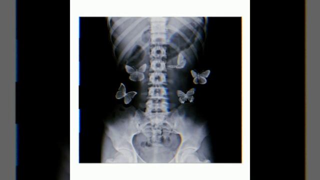 Артем Кей - бабочки в животе [??????] смотреть онлайн