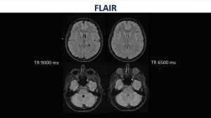 Базовый курс МРТ.Лекция/Импульсные последовательности,в исследованиях головного мозга.ТрофименкоИА