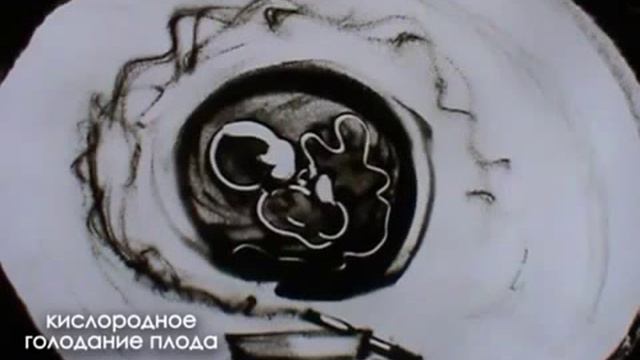 Сделай свой выбор 1 смотреть онлайн