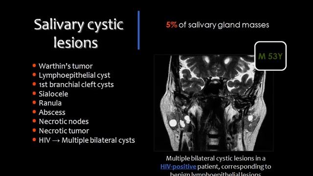 Imaging of Salivary glands - DRE 9 - Dr Mamdouh Mahfouz смотреть онлайн