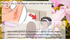 Как вылечить натертости на коже