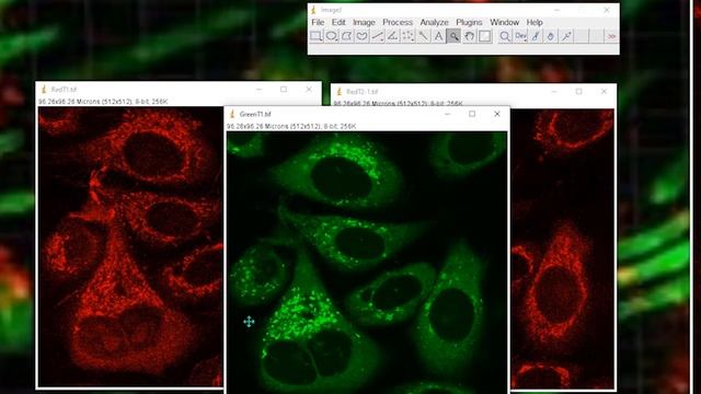 Colocalisation in ImageJ : correcting noisy (poor quality) images смотреть онлайн