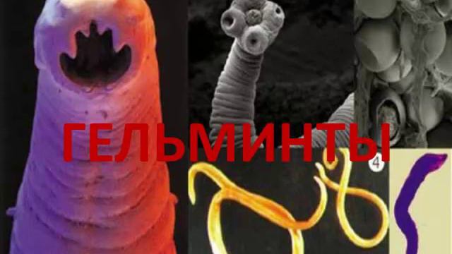Лекция с трансляцией. Зиновьева Дина смотреть онлайн