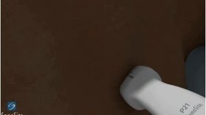 3D-пособие: Получение эхокардиографического изображения в парастернальной проекции по длинной оси