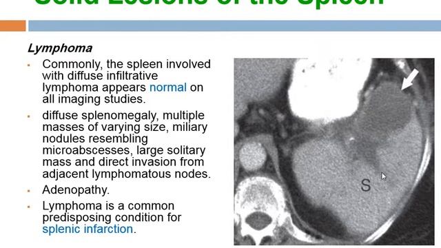 week 28 pancreas, spleen, pharynx and esophagus смотреть онлайн