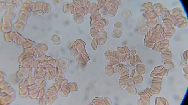 Кровяные тельца под микроскопом