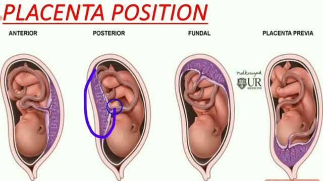 PREGNANCY ULTRASOUND REPORT IN HINDI/PREGNANCY ULTRASOUND REPORT कैसे देखते हैं/PREGNANCY REPORT смотреть онлайн