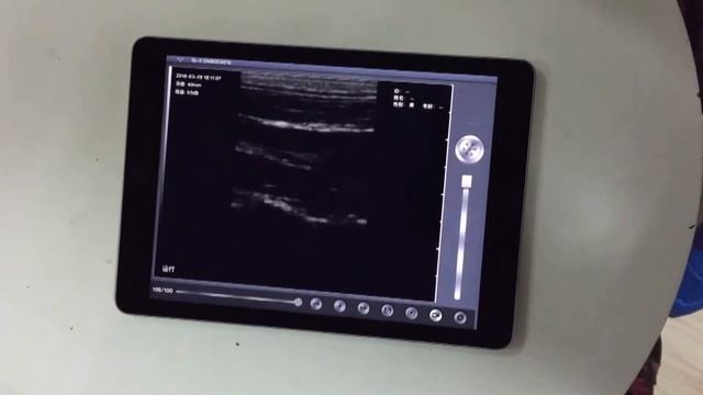 wireless ultrasound probe transducer for ipad, android tablet, computer, vscan pocket ultrasound смотреть онлайн