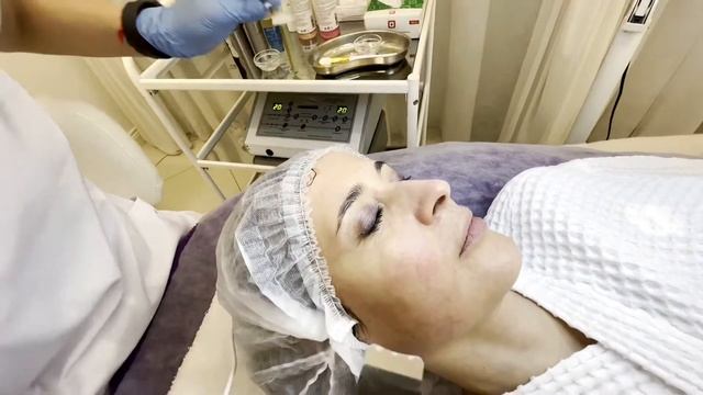 ЧИСТКА ЛИЦА смотреть онлайн