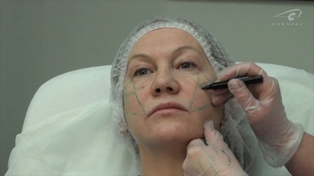 Проверяем разметку. Контурная пластика -обучение 