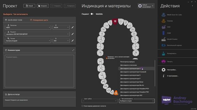проверка активации модуля JAW MOTION IMPORT в exocad 3.0 и 3.1 смотреть онлайн