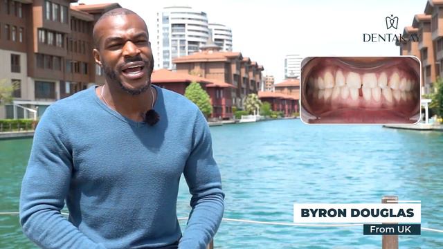 How Mr Byron feels about his NEW Hollywood smile | full review and process смотреть онлайн