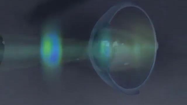 How CustomVue LASIK Captures A WaveScan Map смотреть онлайн