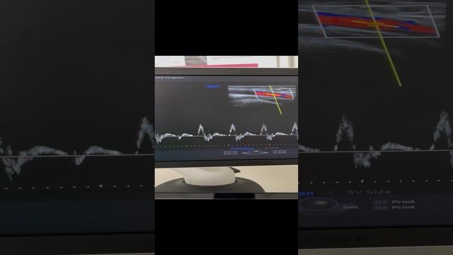 Обследование сосудов. Узи сосудов. Сосудистый хирург. Флеболог Москва. Флеболог смотреть онлайн