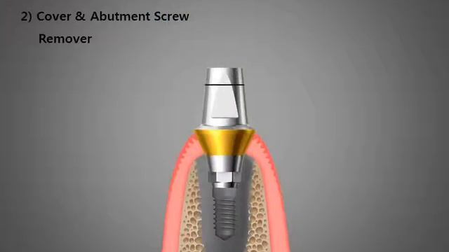 Help Kit смотреть онлайн