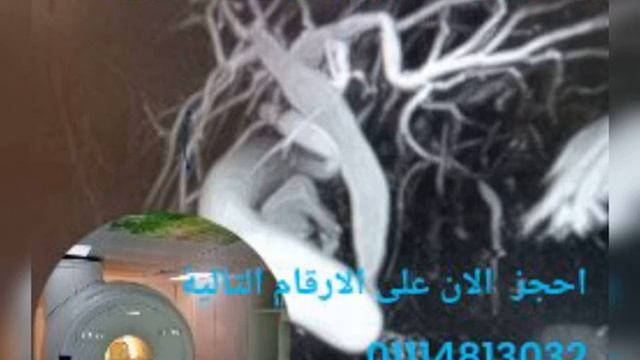 /storage/emulated/0/Download/Photo Video Editor with Music/video_2023_Nov_01_10_43_40.mp4 смотреть онлайн