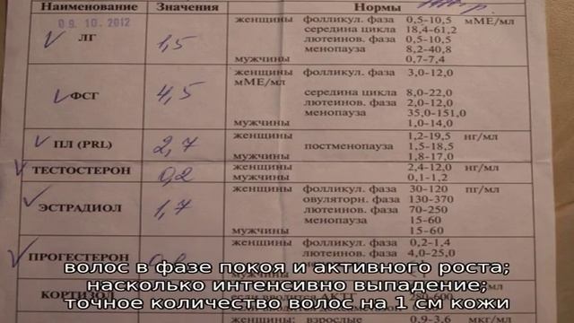 Какие анализы нужно сдать при выпадении волос смотреть онлайн