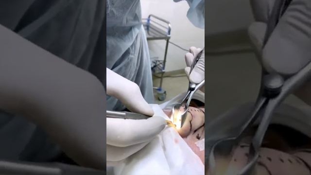 СЕПТОПЛАСТИКА смотреть онлайн