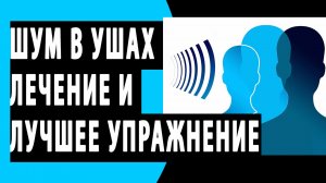 СЕРГЕЙ БУРДУК -ШУМ В УШАХ ЛЕЧЕНИЕ.